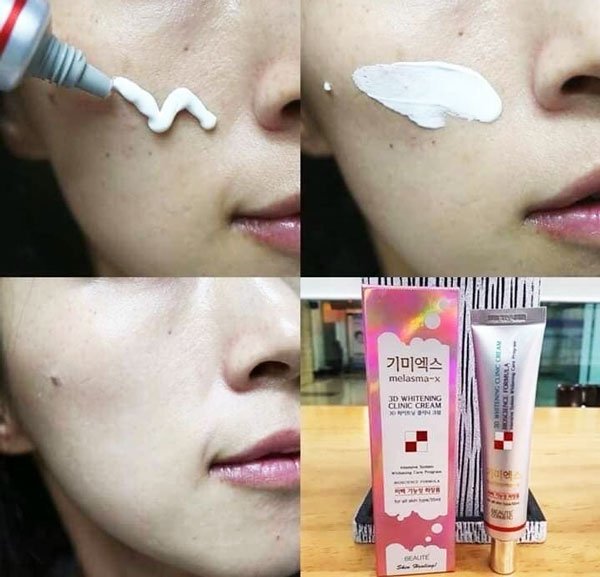 Beaute Melasma 3D Whitening Clinic Renewal Cream (3)