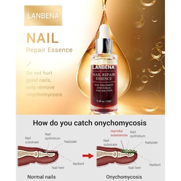 LANBENA Nail Repair Essence Serum (6)