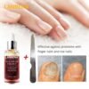 LANBENA Nail Repair Essence Serum (9)